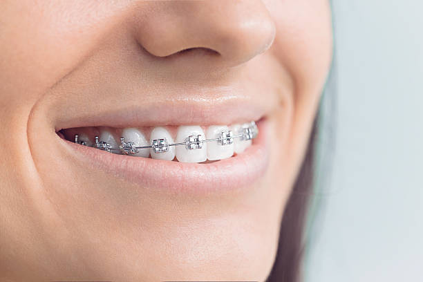 Best Dental Fillings (Composite and Amalgam)  in Homer, LA